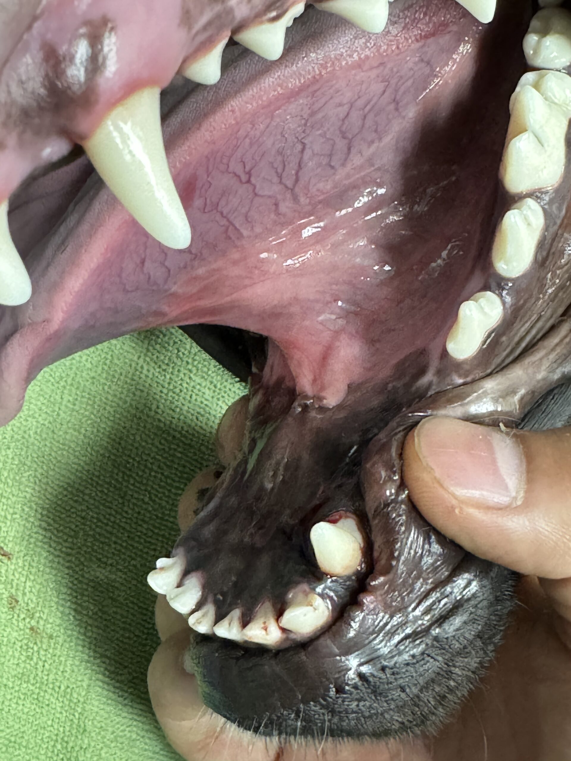 術後経過の写真3